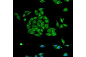 Immunofluorescence analysis of HeLa cells using PICK1 Polyclonal Antibody (PICK1 抗体)