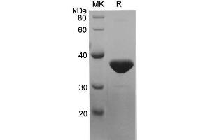 Western Blotting (WB) image for Keratin 7 (KRT7) protein (His tag) (ABIN7320877) (Cytokeratin 7 Protein (His tag))