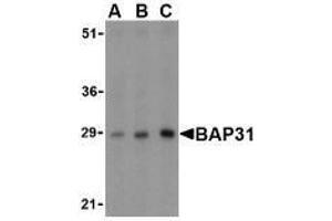 Western blot analysis of BAP31 in rat lung tissue lysate with AP30124PU-N BAP31 antibody at (A) 0. (BCAP31 抗体  (Intermediate Domain))
