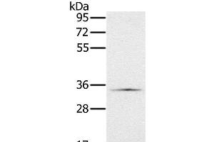 Western Blot analysis of Hela cell using NDUFA9 Polyclonal Antibody at dilution of 1:400 (NDUFA9 抗体)