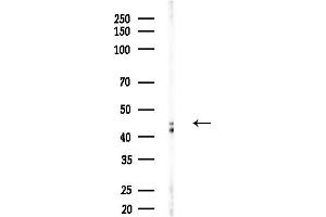 anti-Vitamin D Receptor (VDR) (Internal Region) antibody