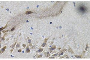 Immunohistochemistry of paraffin-embedded Mouse brain using NTRK1 Polyclonal Antibody at dilution of 1:100 (40x lens). (TRKA 抗体)
