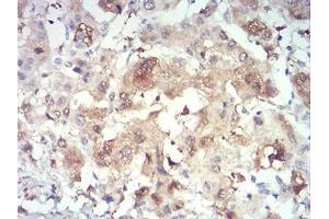 Immunohistochemistry (IHC) image for anti-PR Domain Containing 4 (PRDM4) (AA 476-575) antibody (ABIN5874480) (PRDM4 抗体  (AA 476-575))