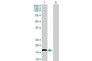 Lane 1: IL15 transfected lysate ( 17. (IL15 293T Cell Transient Overexpression Lysate(Denatured))