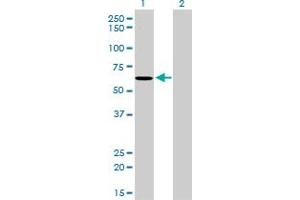 Western Blot analysis of NDOR1 expression in transfected 293T cell line by NDOR1 monoclonal antibody (M01), clone 3A11. (NDOR1 抗体  (AA 498-595))