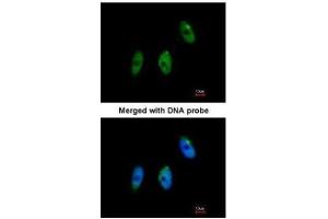 ICC/IF Image Immunofluorescence analysis of paraformaldehyde-fixed HeLa, using ELP3, antibody at 1:100 dilution. (ELP3/KAT9 抗体  (Center))
