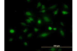Immunofluorescence of monoclonal antibody to STAT5B on HeLa cell. (STAT5B 抗体  (AA 678-787))