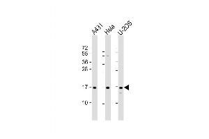 Western Blot at 1:2000 dilution Lane 1: A431 whole cell lysate Lane 2: Hela whole cell lysate Lane 3: U-2OS whole cell lysate Lysates/proteins at 20 ug per lane. (RPLP1 抗体  (AA 18-49))