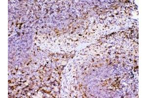IHC testing of FFPE mouse spleen tissue with ADA antibody at 1ug/ml.