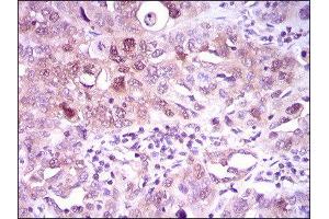 Immunohistochemistry (IHC) image for anti-ATP Citrate Lyase (ACLY) (AA 306-502) antibody (ABIN1842880) (ACLY 抗体  (AA 306-502))