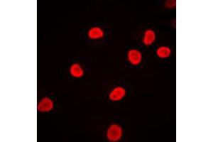 Immunofluorescent analysis of hnRNP F staining in Jurkat cells. (HNRNPF 抗体  (N-Term))