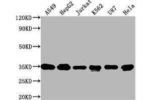 Western Blot Positive WB detected in: A549 whole cell lysate, HepG2 whole cell lysate, Jurkat whole cell lysate, K562 whole cell lysate, U87 whole cell lysate, Hela whole cell lysate All lanes: SUMF2 antibody at 1:2000 Secondary Goat polyclonal to rabbit IgG at 1/50000 dilution Predicted band size: 34, 25, 38, 24, 35 kDa Observed band size: 34 kDa (SUMF2 抗体  (AA 26-301))