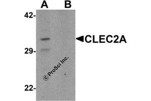 Western Blotting (WB) image for anti-C-Type Lectin Domain Family 2, Member A (CLEC2A) (N-Term) antibody (ABIN1031323) (CLEC2A 抗体  (N-Term))