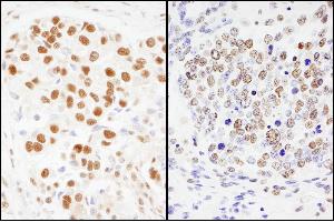 Immunohistochemistry (IHC) image for anti-Splicing Factor 3a, Subunit 1 (SF3A1) (AA 350-400) antibody (ABIN7454763)