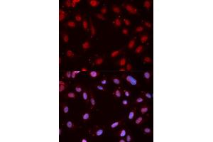 Immunofluorescence analysis of MCF-7 cells using Phospho-CHEK1-S280 antibody (ABIN5969878). (CHEK1 抗体  (pSer280))