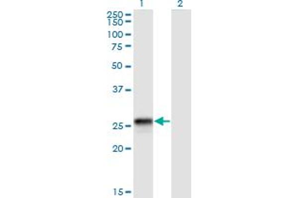 HLA-DQB2 anticorps  (AA 1-231)