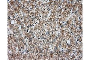 Immunohistochemical staining of paraffin-embedded liver tissue using anti-BTK mouse monoclonal antibody. (BTK 抗体)
