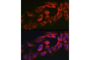 Immunofluorescence analysis of U2OS cells using MYO10 antibody (ABIN6128319, ABIN6144271, ABIN6144274 and ABIN6216113) at dilution of 1:350. (Myosin X 抗体  (AA 845-944))