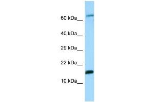 WB Suggested Anti-Hbe1 Antibody Titration: 1. (Hemoglobin, epsilon 1 (HBe1) (N-Term) 抗体)