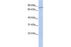 WB Suggested Anti-F2 Antibody  Titration: 1 ug/ml Positive Control: 721_B cell lysate (Prothrombin 抗体  (Middle Region))