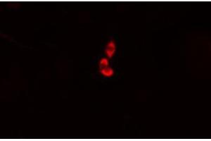 ABIN6274976 staining HepG2 cells by IF/ICC. (COMT 抗体  (N-Term))