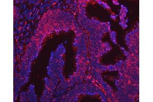 IF analysis of ARL1 using anti-ARL1 antibody (ABIN7602848).
