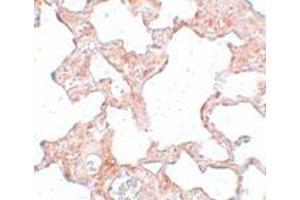 Immunohistochemistry (IHC) image for anti-Protein Kinase Domain Containing, Cytoplasmic Homolog (Mouse) (PKDCC) (Middle Region) antibody (ABIN1031161) (PKDCC 抗体  (Middle Region))