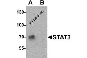 Western Blotting (WB) image for anti-Signal Transducer and Activator of Transcription 3 (Acute-Phase Response Factor) (STAT3) (N-Term) antibody (ABIN1077432) (STAT3 抗体  (N-Term))