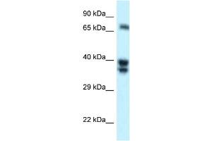 WB Suggested Anti-SH3BP1 Antibody Titration: 1. (SH3BP1 抗体  (N-Term))