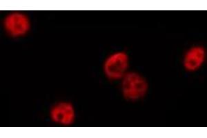 ABIN6274894 staining HepG2 by IF/ICC. (DQX1 抗体  (Internal Region))