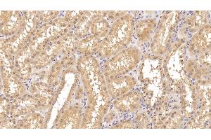 Detection of INSR in Human Kidney Tissue using Monoclonal Antibody to Insulin Receptor (INSR) (Insulin Receptor 抗体)