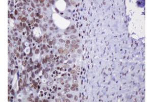 Image no. 1 for anti-Decapping Enzyme, Scavenger (DCPS) antibody (ABIN1497781) (DCPS 抗体)