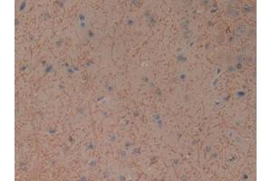 DAB staining on IHC-P; Samples: General Stomach Tissue) (GIP 抗体)