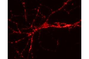 Immunofluorescence labeling of hippocampus neurons (dilution 1 : 500). (VAMP1, 2, 3 (AA 1-81) 抗体)