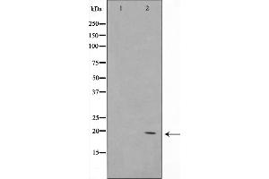 Western blot analysis on K562 cell lysate using COX42 Antibody，The lane on the left is treated with the antigen-specific peptide. (COX4I2 抗体  (Internal Region))