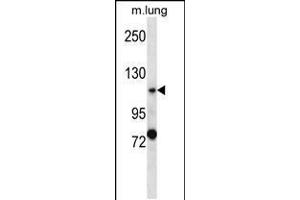 Western blot analysis in mouse lung tissue lysates (35ug/lane). (PKD2 抗体  (C-Term))