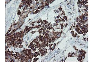 Image no. 2 for anti-Mitochondrial Ribosomal Protein S27 (MRPS27) (AA 151-414) antibody (ABIN1490963) (MRPS27 抗体  (AA 151-414))