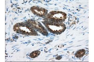 Immunohistochemical staining of paraffin-embedded Human Kidney tissue using anti-ACAT2 mouse monoclonal antibody. (ACAT2 抗体)