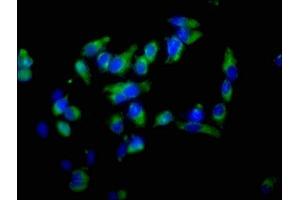 Immunofluorescence staining of Hela cells with ABIN7152369 at 1:100, counter-stained with DAPI. (Ezrin 抗体  (AA 1-251))