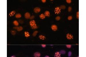 Immunofluorescence (IF) image for anti-DNA (Cytosine-5)-Methyltransferase 1 (DNMT1) antibody (ABIN7259344)