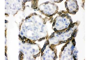 Immunohistochemistry (IHC) image for anti-3-phosphoinositide Dependent Protein Kinase-1 (PDPK1) (AA 524-556), (C-Term) antibody (ABIN3043600)
