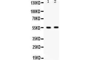 Western Blotting (WB) image for anti-gamma-aminobutyric Acid (GABA) A Receptor, beta 3 (GABRB3) (AA 344-375), (C-Term) antibody (ABIN3042414)