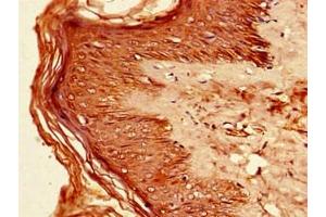 Immunohistochemistry of paraffin-embedded human skin tissue using ABIN7156631 at dilution of 1:100 (IRF7 抗体  (AA 131-289))