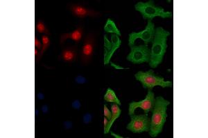 ABIN6264198 and ABIN6266655 staining Hela cells by IF/ICC. (PIAS3 抗体  (N-Term))