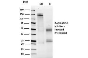SDS-PAGE Analysis Purified MCM6 Mouse Monoclonal Antibody (MCM6/2999). (MCM6 抗体  (AA 228-368))