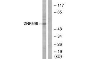 Western blot analysis of extracts from Jurkat cells, using ZNF596 Antibody. (ZNF596 抗体  (AA 261-310))