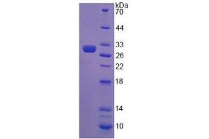 SDS-PAGE analysis of Chicken AMH Protein. (AMH 蛋白)