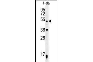 DDX47 Antibody (C-term) (ABIN652169 and ABIN2840575) western blot analysis in Hela cell line lysates (35 μg/lane). (DDX47 抗体  (C-Term))