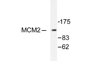 Image no. 1 for anti-Minichromosome Maintenance Complex Component 2 (MCM2) antibody (ABIN265514) (MCM2 抗体)