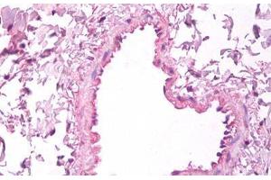 Anti-VEGF antibody IHC staining of human lung, vascular endothelium. (VEGFA 抗体)